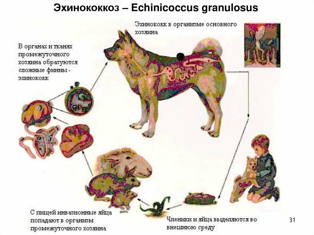 Эхиноккоз. Эхиноккоз