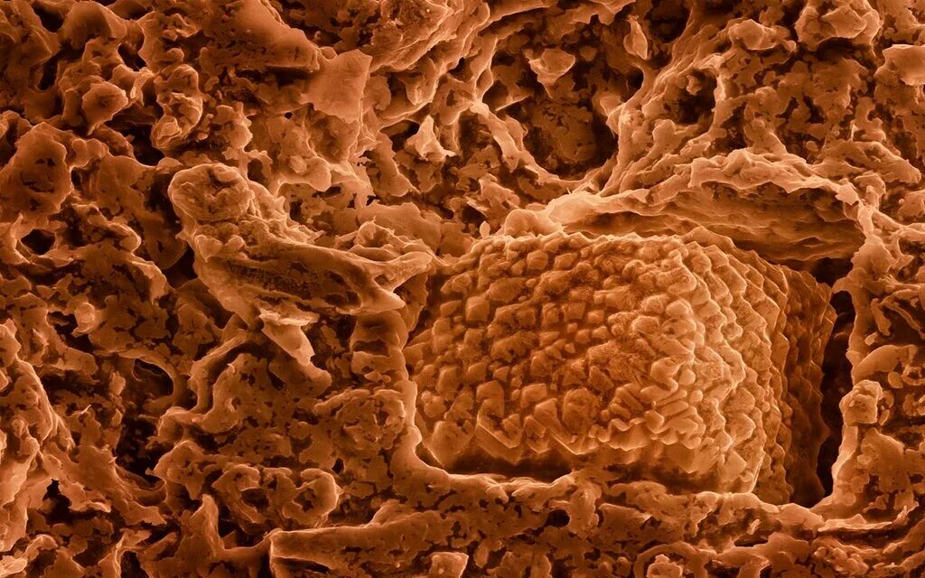 перекрест волос под микроскопом. застежка липучка и репейник. перекрест волос под микроскопом малое увеличение. вещи увеличенные под микроскопом. вещи под микроскопом.