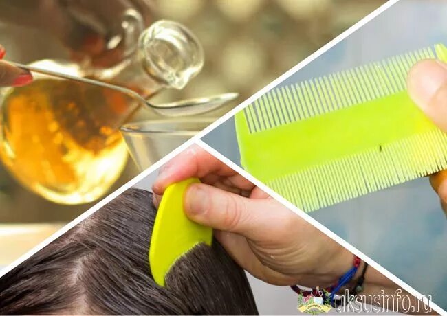 Педикулез вычесывание. Избавиться от вшей с помощью. Гребешок для вычесывания вшей. Вычесывание вшей. Избавиться от вшей с помощью.