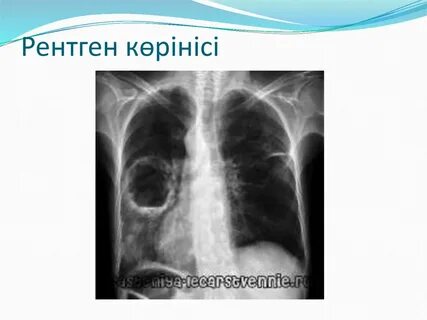 Сексуалдық рентген