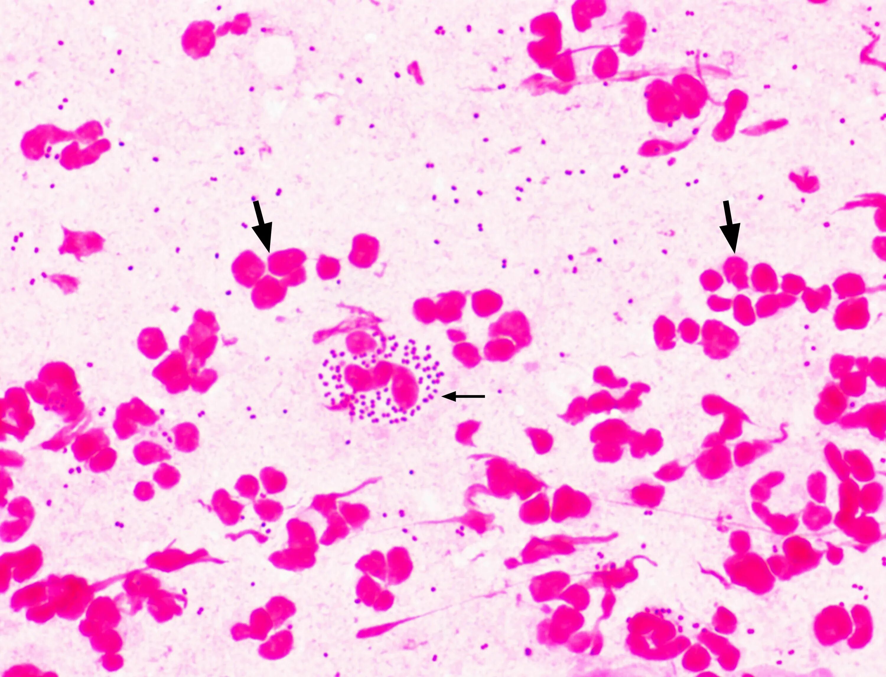 Chlamydia trachomatis neisseria gonorrhoeae. Нейссерия менингококк. Neisseria gonorrhoeae микроскопия. Нейссерии гонореи в мазке.