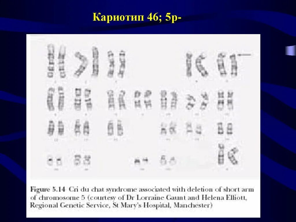 Идиограмма кариотипа. В кариотипе яблони 34. Идиограмма кариотипа. Кариотип человека хромосомы. В кариотипе яблони 34.