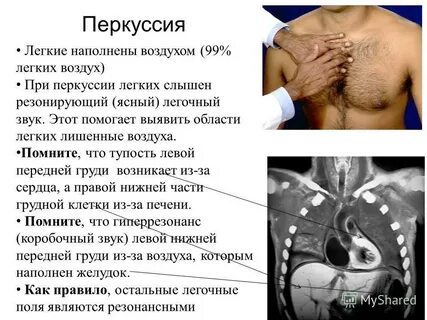 Перкуссия при эмфиземе