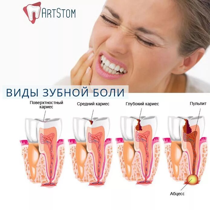 После холодной воды болит. Зубная боль. Боль в зубе.