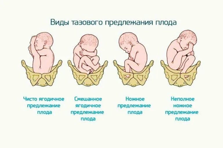 Полное положение