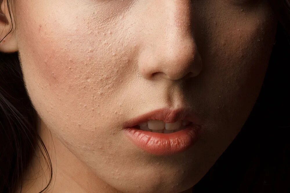 Лицо человека. Лицо до ретуши. Без ретуширования. Портрет без ретуши. Профессиональная ретушь женского портрета.