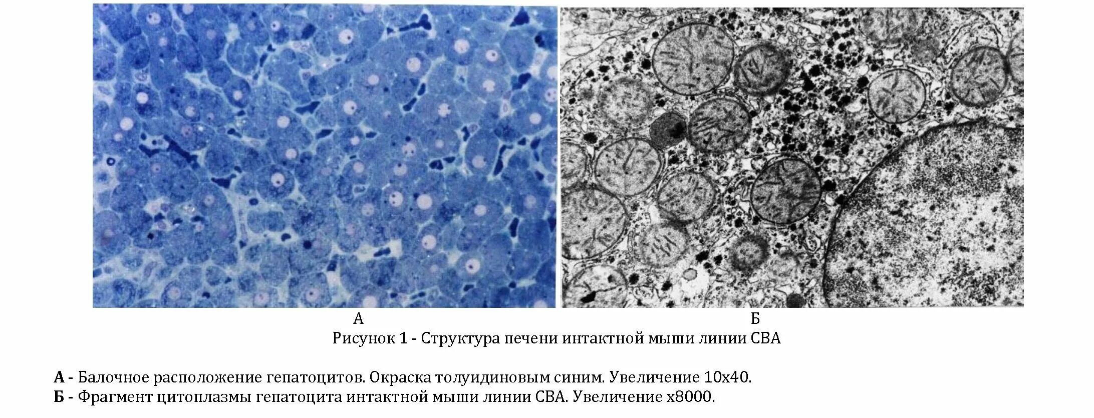 Митохондрии в клетках печени. Многоядерные клетки печени. Клетки печени аксолотля. Хондриосомы в клетках печени амфибии. Клетки печени гепатоциты.