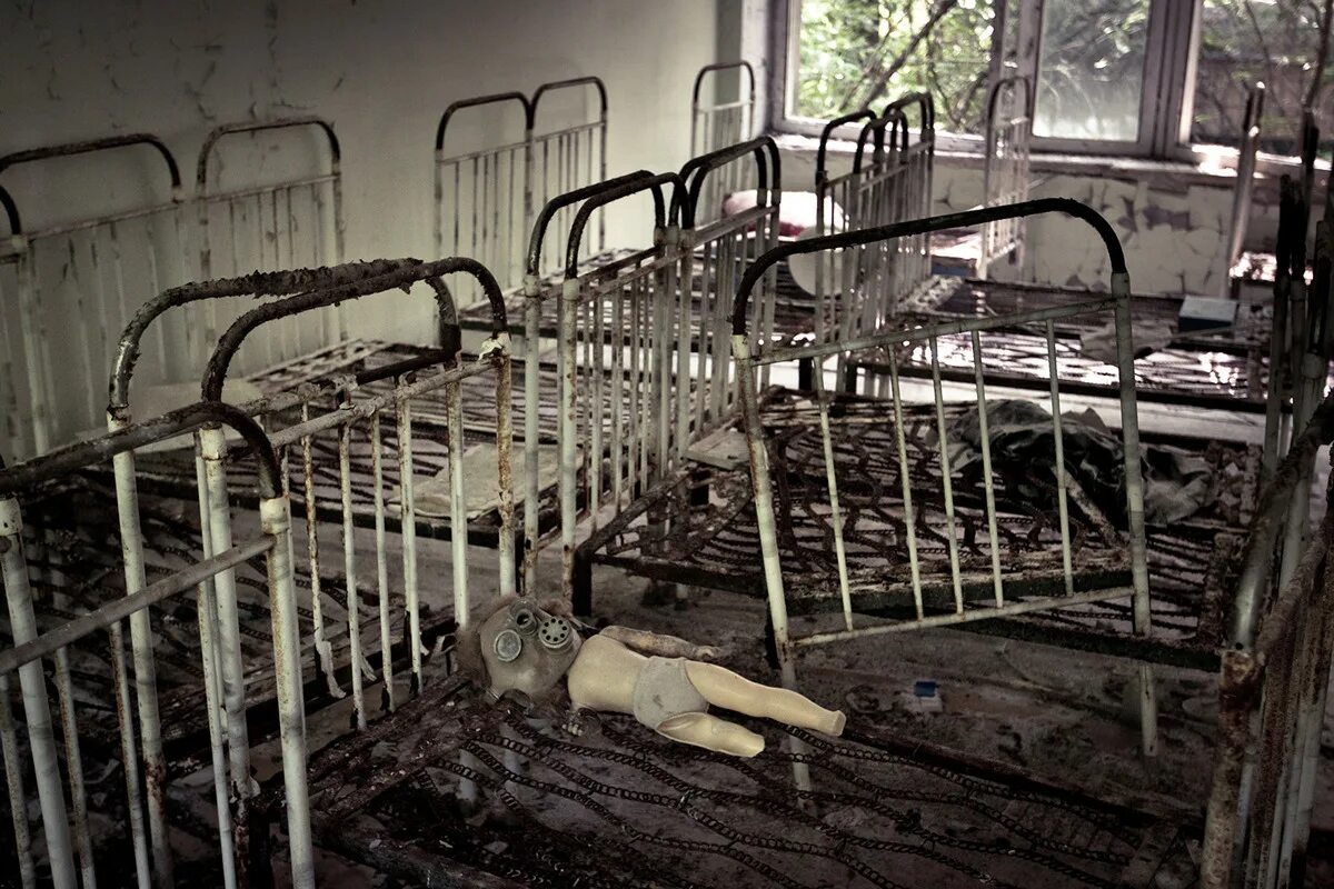 Чернобыль ЧАЭС болезнь. Лучевая болезнь ЧАЭС Чернобыль. Чернобыль 1986 больница пациенты. Больные люди в Чернобыле. Люди заражение радиацией
