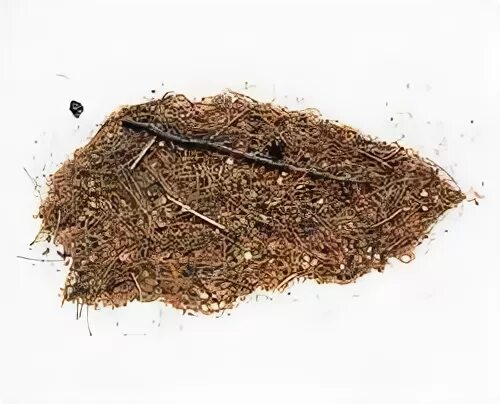 Детрит. Детрит это. Детрит. Микроскопия желчи нативный препарат. Детрит в кале у взрослого что это значит.