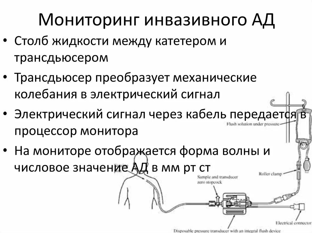 Инвазивный (прямой) метод измерения артериального давления.. Инвазивный метод измерения давления. Катетер для инвазивного измерения ад. Методика измерения ЦВД центрального венозного давления. Методы гемодинамики