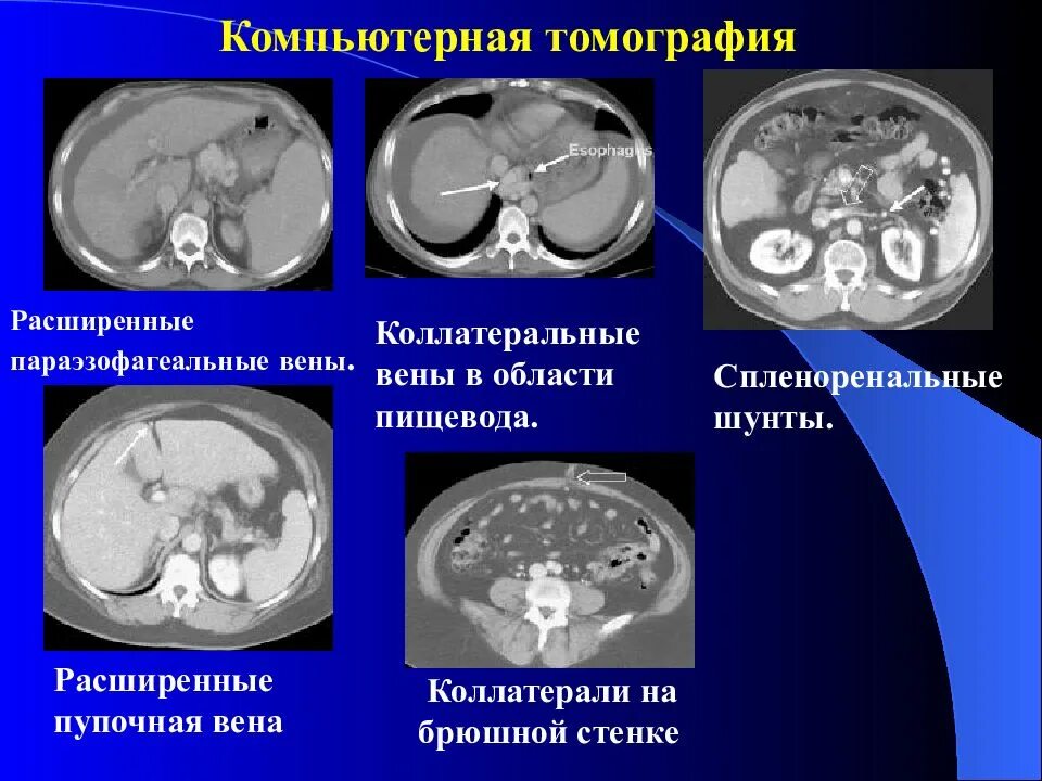 Расширенное кт