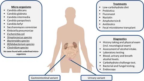 O que é a Síndrome de Fermentação intestinal? 