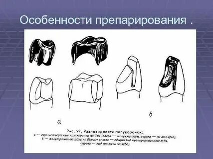 Препарирование это