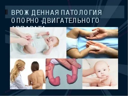 Врожденные и приобретенные деформации