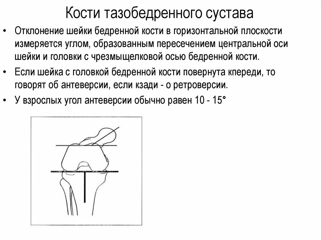 Горизонтальная ось тазобедренного сустава. Анатомия шейки бедренной кости. Ось шейки бедренной кости. Остеопластика шейки бедренной кости.