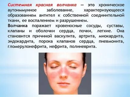 Синдром красной