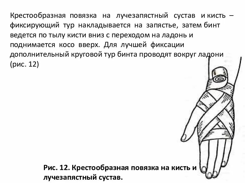 Крестообразная бинтовая повязка. Крестообразная повязка на руку. Крестообразная повязка на руку. Крестообразная перевязка на кисть. Транспортная иммобилизация при переломе ребер и грудины.