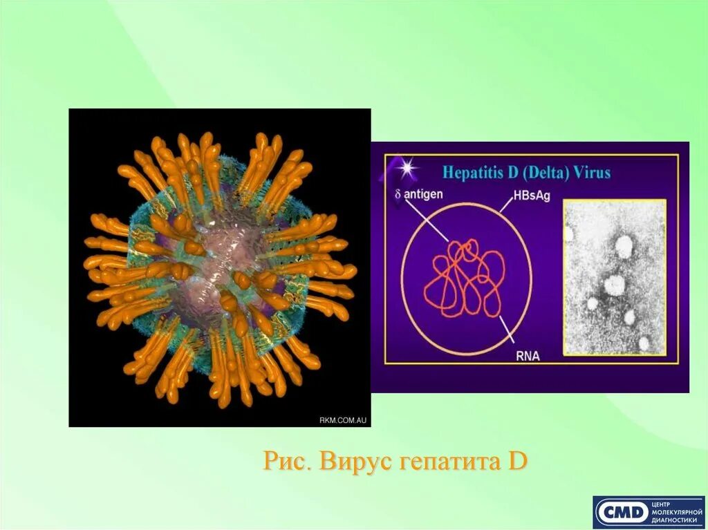 Возбудитель гепатита d. Возбудитель гепатита Дельта. Вирус гепатита д. Возбудителем вирус гепатит д.