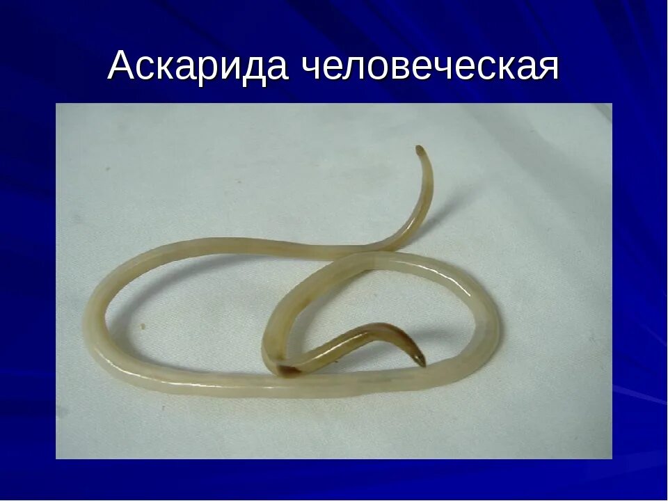 В каком органе обитает взрослая особь аскариды. Круглые черви аскарида человеческая. Аскариды острицы власоглав трихинеллы токсокары. Круглый червь человеческая аскарида.