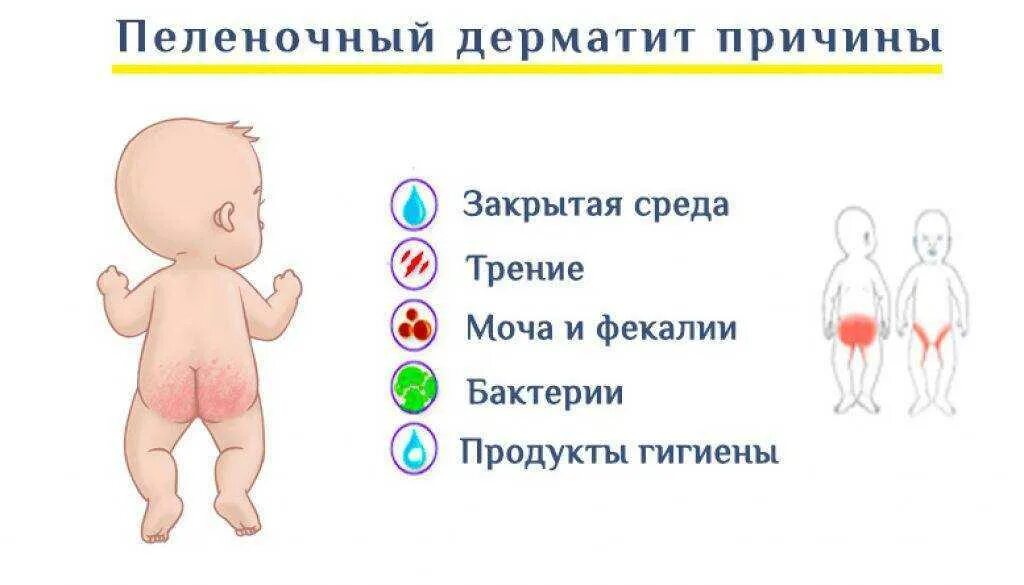 Газы у новорожденного форум