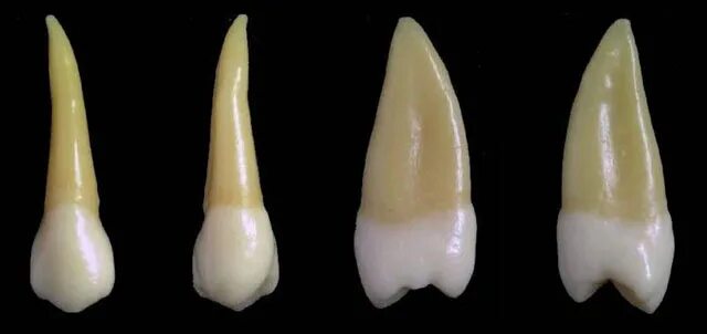 Корень зуба клык. Второй премоляр верхней челюсти анатомия. Анатомия зубов премоляр. Молочный премоляр верхней челюсти. Корни зубов премоляр верхней челюсти.