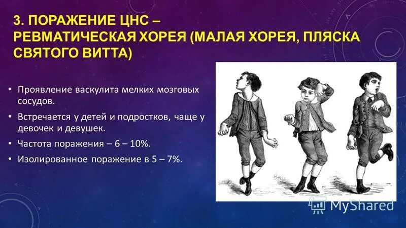 Болезнь Хантингтона пляска Святого Витта. Малая Хорея пляска Святого Витта. Ревматическая Хорея (пляска Святого Витта).. Хорея Гентингтона пляска Святого Витта.