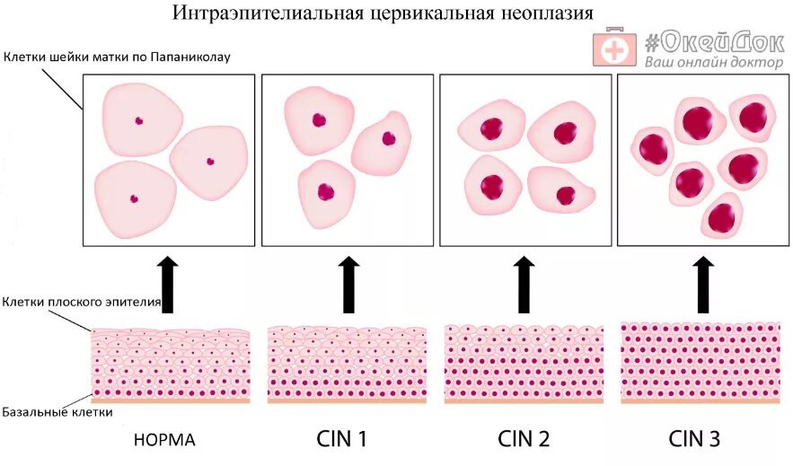 Можно Ли Заниматься Сексом Перед Цитологией