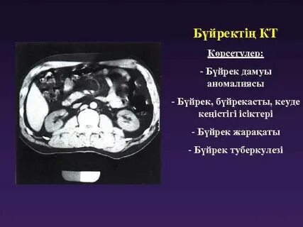 Ауылдың қатерлі ісігінің суреті