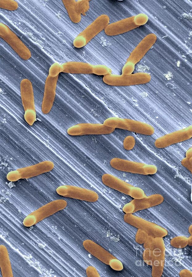 Clostridium difficile микробиология. Бактерия клостридия. Бактерии рода клостридиум.