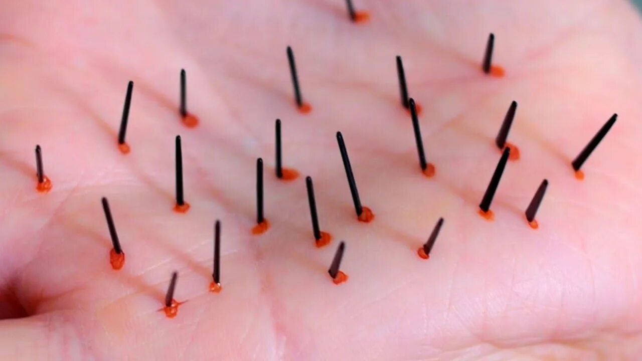 Needle out