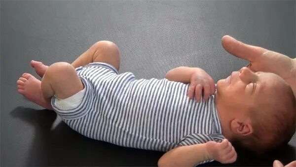 Новорождённые дети с ДЦП. Дцп 3 месяца