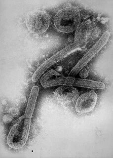 Marburg virus