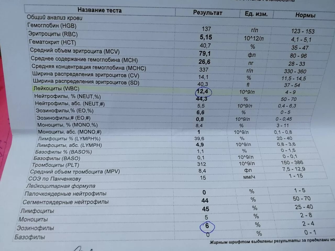 О чем говорит повышенный анализ. Лимфоциты моноциты гранулоциты норма. Нормальные показатели лимфоцитов в крови у взрослых. Показатели крови лимфоциты моноциты лейкоциты. Анализ крови лимфоциты норма.