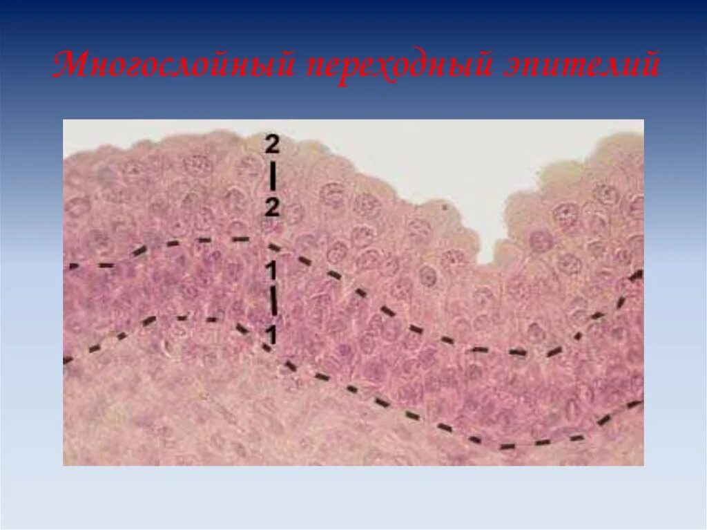 Слои переходного эпителия. Многослойный переходный эпителий. Эпителий мочевого пузыря гистология. Многослойный плоский переходный эпителий. Строение переходного эпителия гистология.