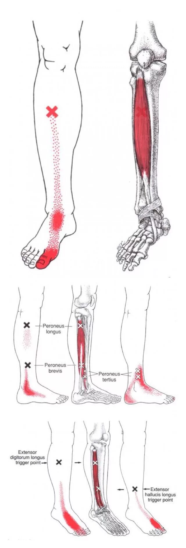 Триггерные точки голеностопного сустава. Триггер в большеберцовой мышце. Триггерные точки ноги голени. Голень и стопа триггерные точки.