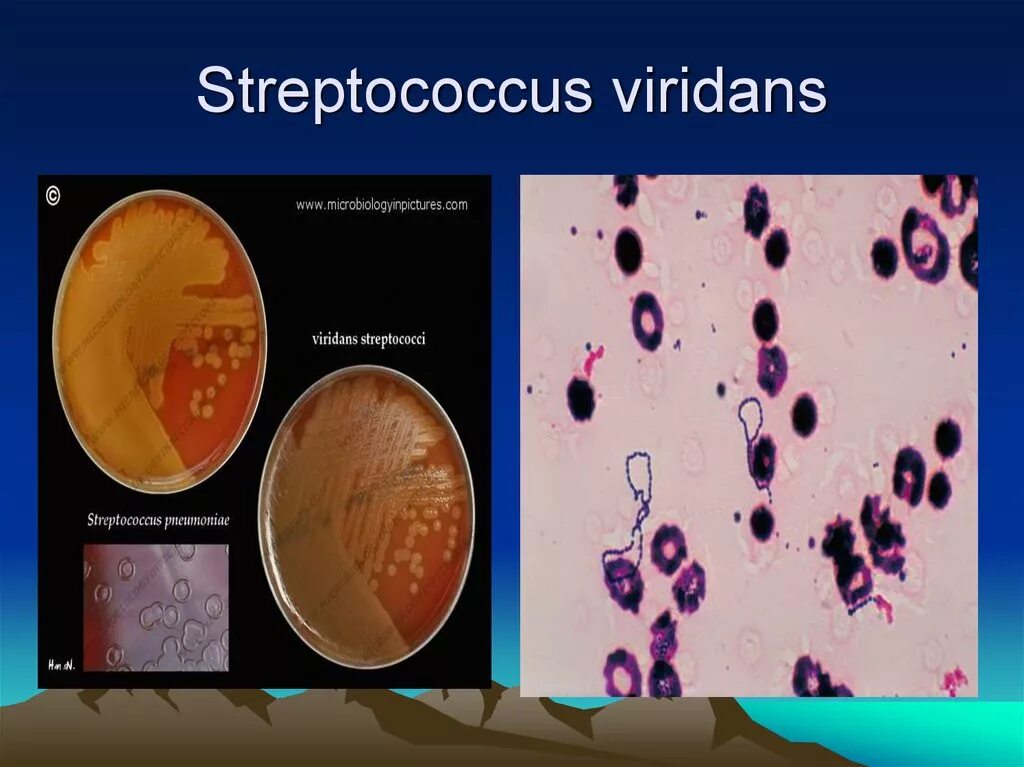 Streptococcus Viridans Group 1000 обнаружено что это. Streptococcus SPP. Группы Viridans.