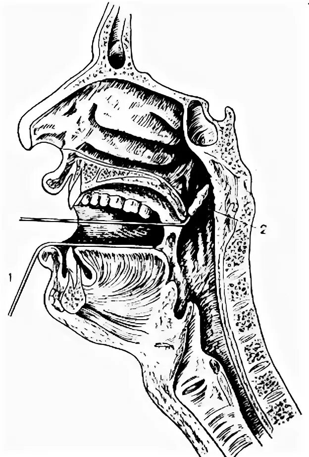 Взятие мазка на менингококк алгоритм. Взятие мазеп изьносоглотки на менигоко. Взятие мазка из зева и носа алгоритм. Взятие мазка из зева и носа на дифтерию. Методика забора мазков из носа и зева.
