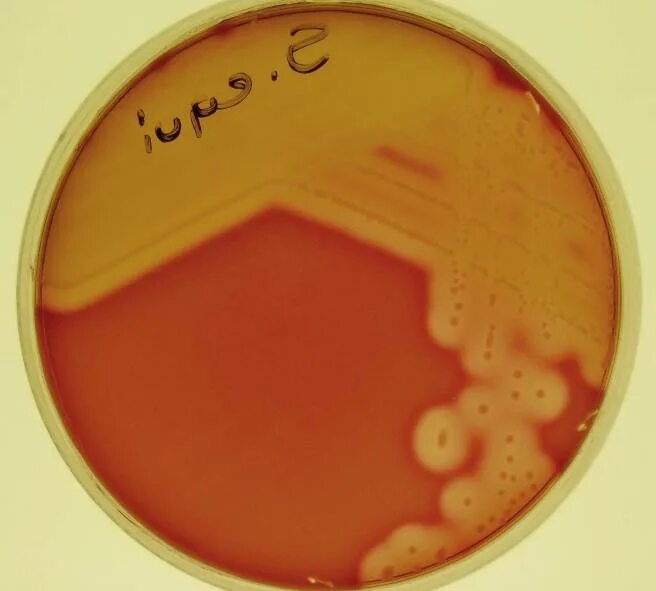 Гемолитический латынь. Гемолитический стрептококк Streptococcus. Гемолитический стрептококк pyogenes. B стрептококк гемолитический стрептококк. Гемолитический стрептококк группы а.