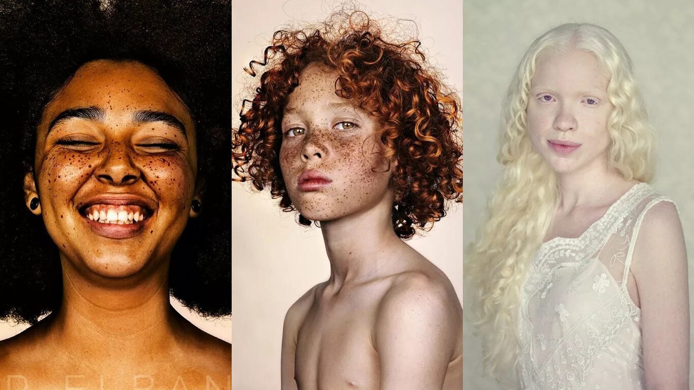 Нестандартная реакция. Люди с неординарной внешностью. Необычная внешность. Необычный цвет кожи. Люди с особенностями внешности.