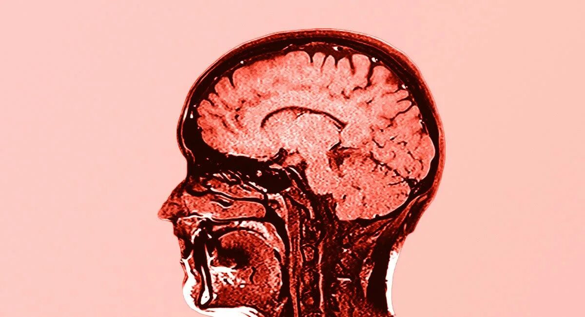 Brain mass