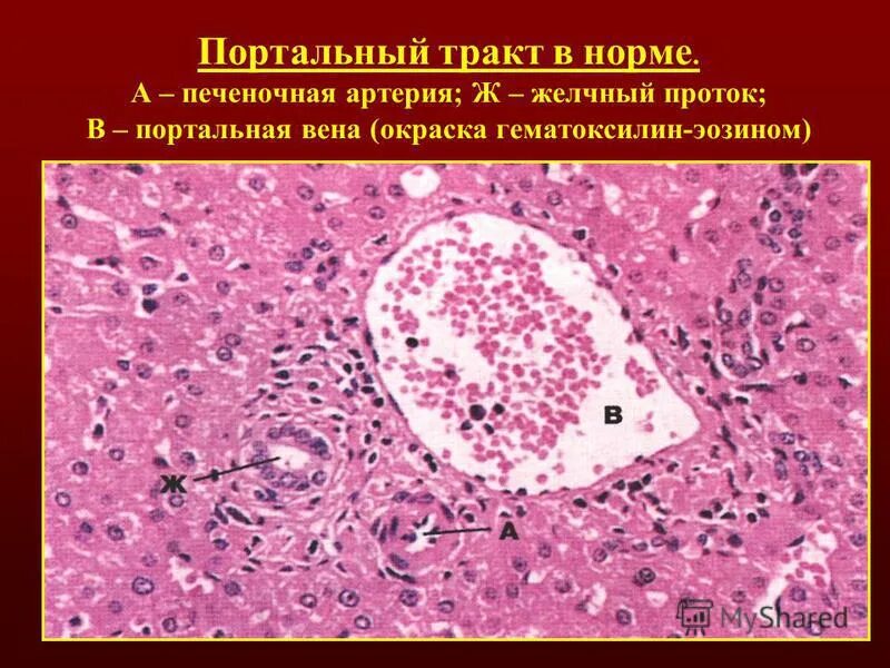 строение печени портальный тракт. печеночная долька гистология препарат. портальный тракт печени. строение печени норма гистология. портальный тракт печени гистология.