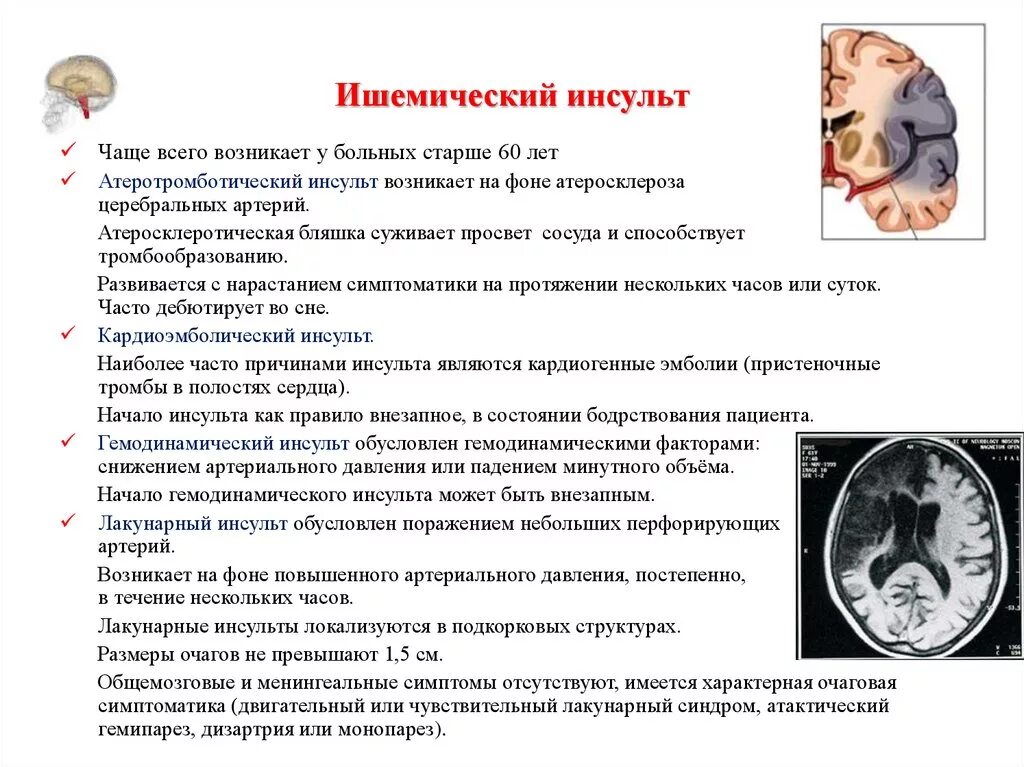 Прогнозы после ишемического инсульта. Прогнозы после ишемического инсульта