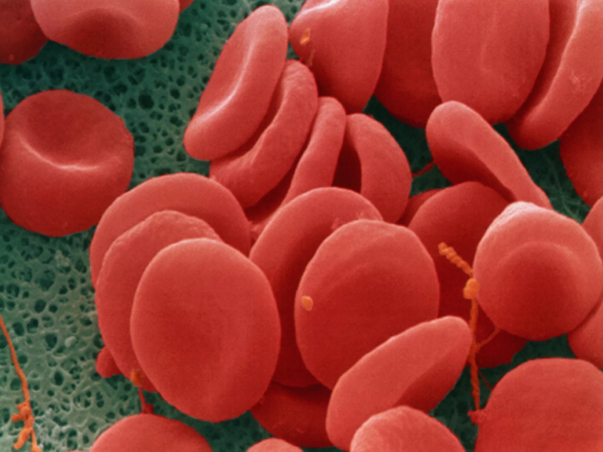 Эритроциты в крови микроскоп. Кровь под микроскопом. Эритроциты под микроскопом. Кровь человека под микроскопом.