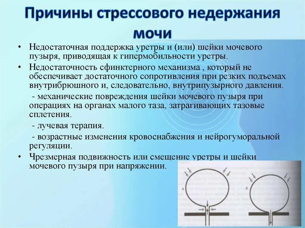 Стрессовое недержание мочи факторы. Стрессовое недержание мочи у женщин. Причины недержания мочи у женщин. Стрессовое недержание мочи у женщин причины