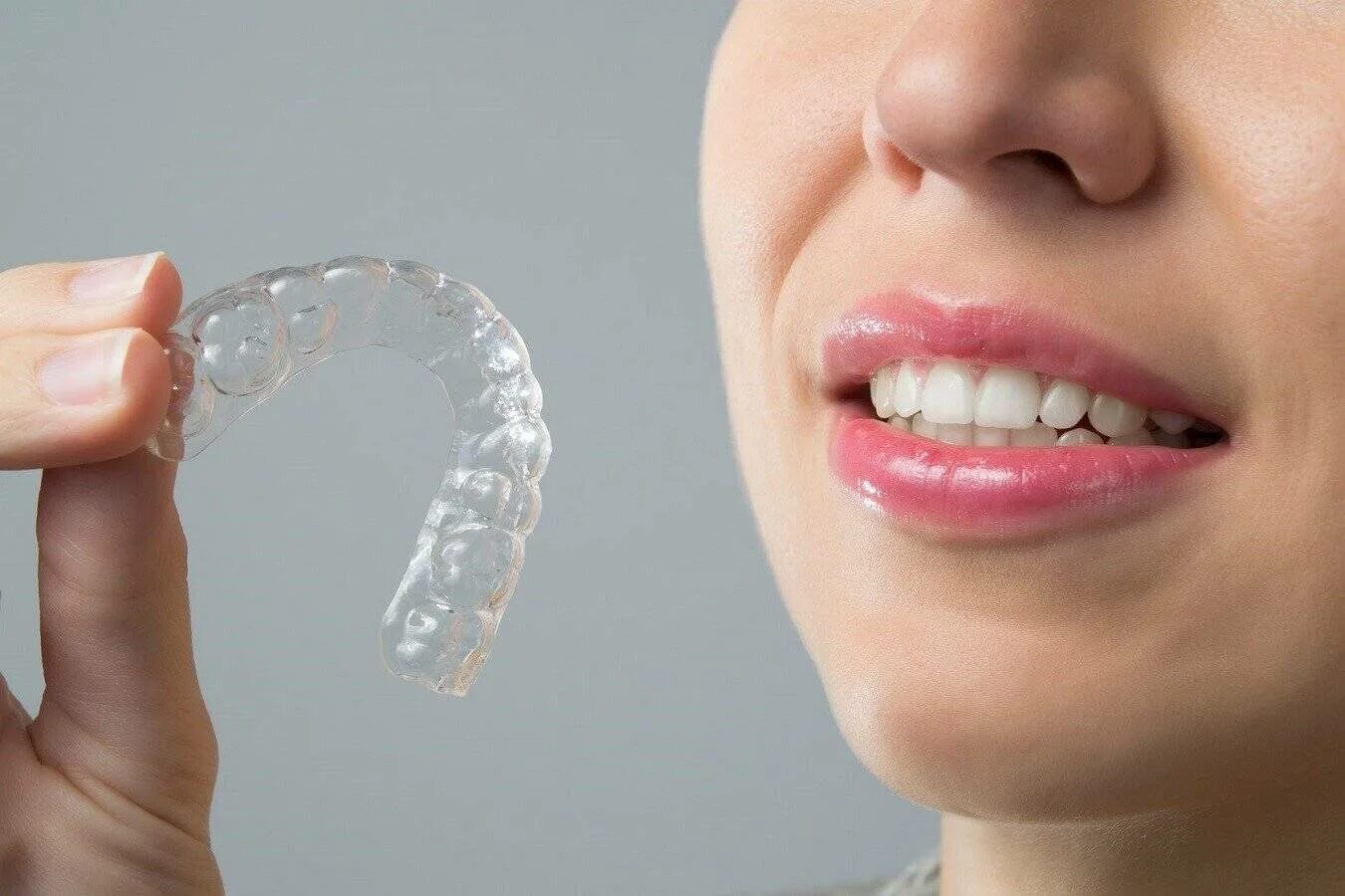 Каппы Инвизилайн. Элайнеры ортодонтия. Элайнеры Invisalign. Элайнеров Invisalign. Clear что делает