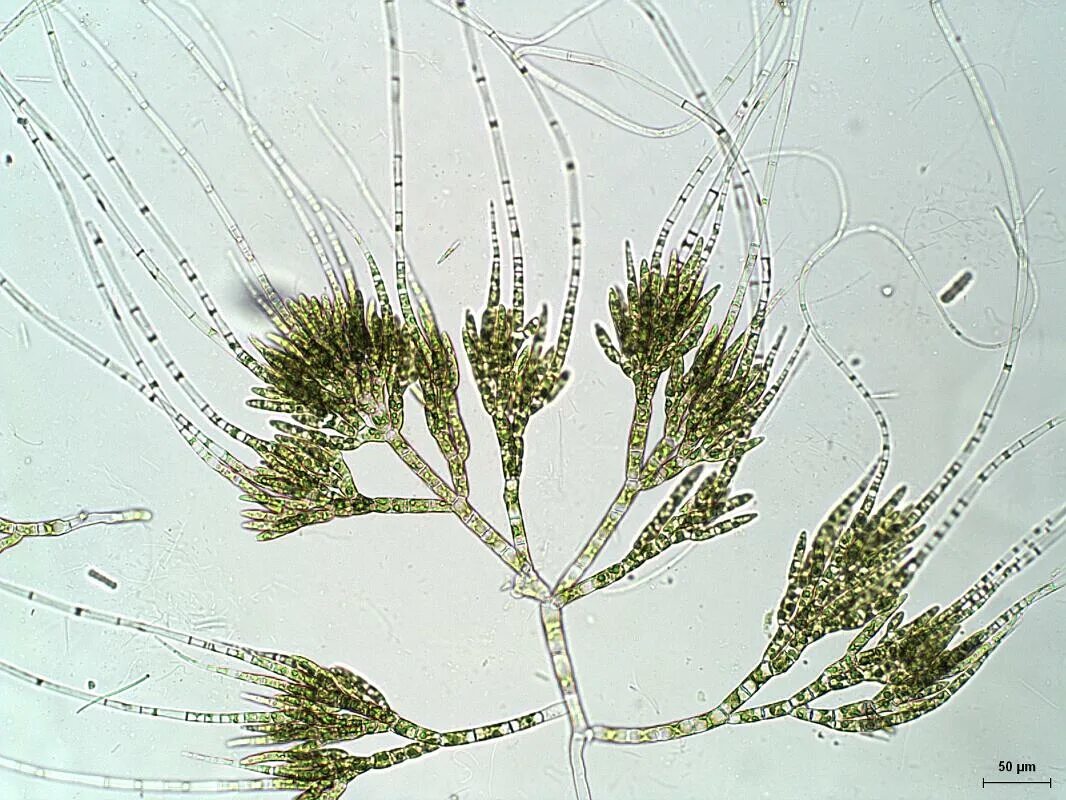 Отсутствие водорослей. Стигеоклониум водоросль. Таллом водоросли драпарнальдия. Хетофоровые водоросли. Драпарнальдия водоросль Байкала.