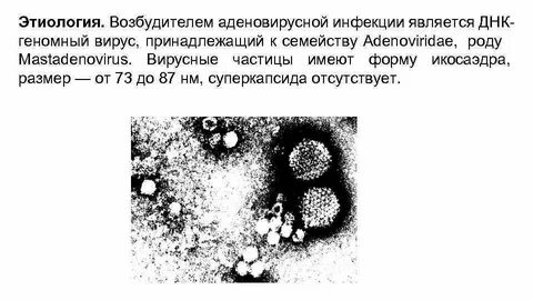 Аденовирусная инфекция этиология