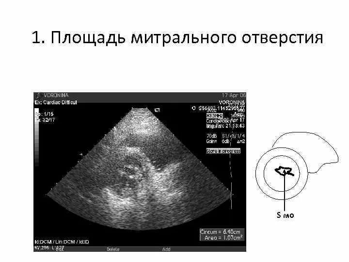 Площадь митрального