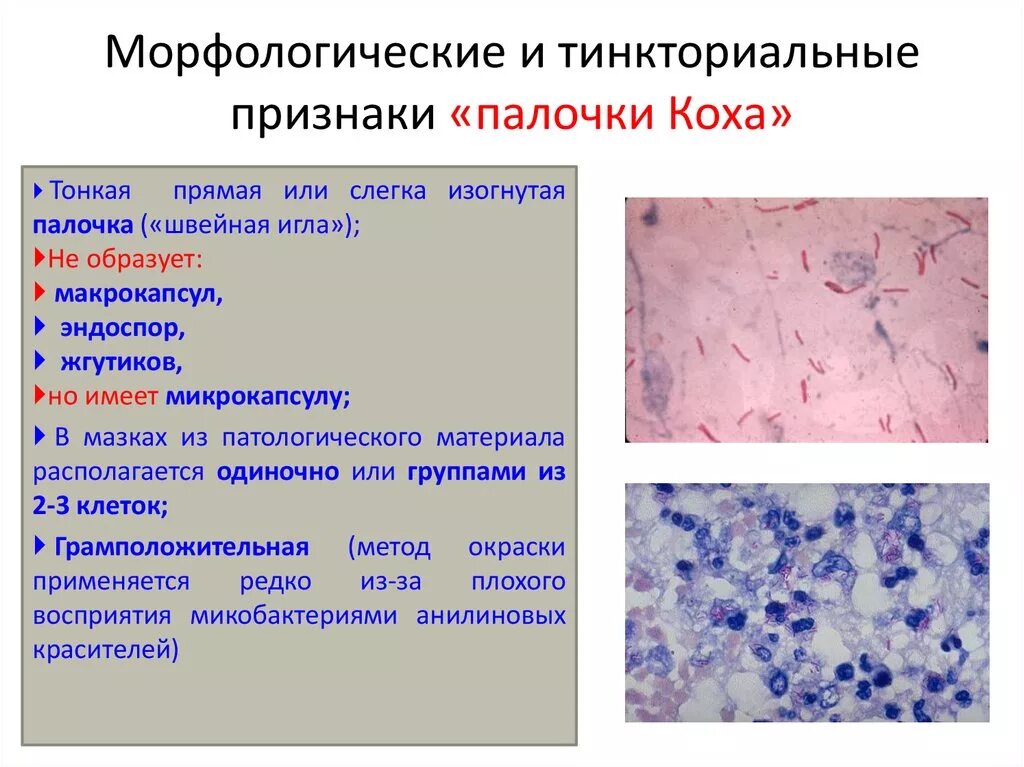 Микобактерии туберкулеза формы. Морфологические и тинкториальные свойства Mycobacterium tuberculosis. Микобактерия туберкулеза палочка Коха. Морфология микобактерий туберкулеза. Морфология палочки Коха туберкулез.