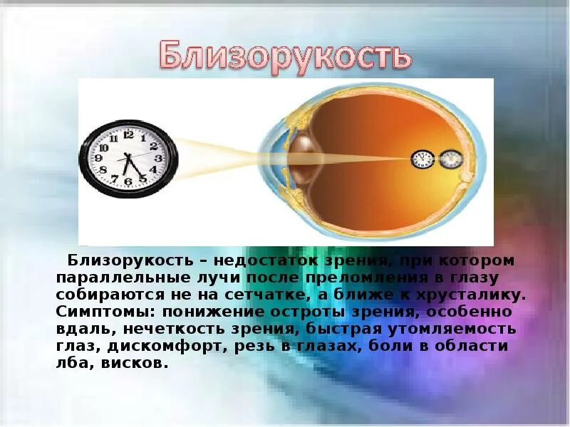 Дополните предложения изображение в близоруком